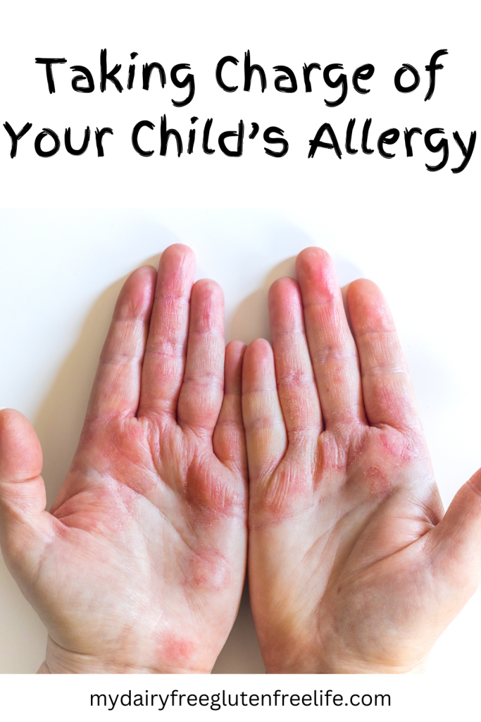Taking Charge of Your Child’s Allergy