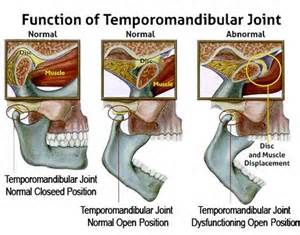 TMJ and how Dentists can help