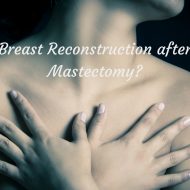 Breast Reconstruction after Mastectomy?