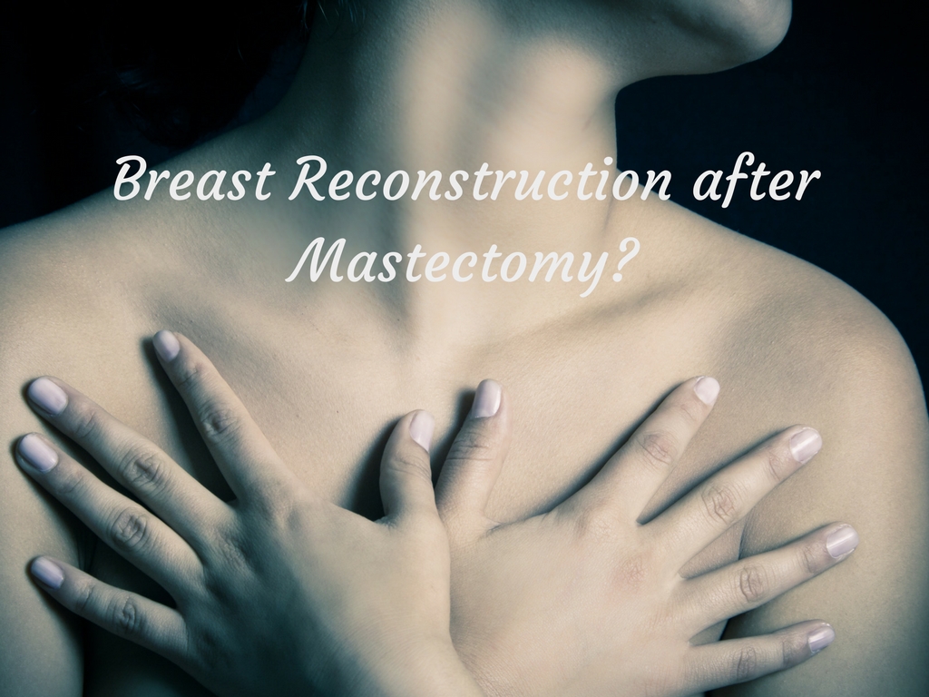 Breast Reconstruction after Mastectomy?