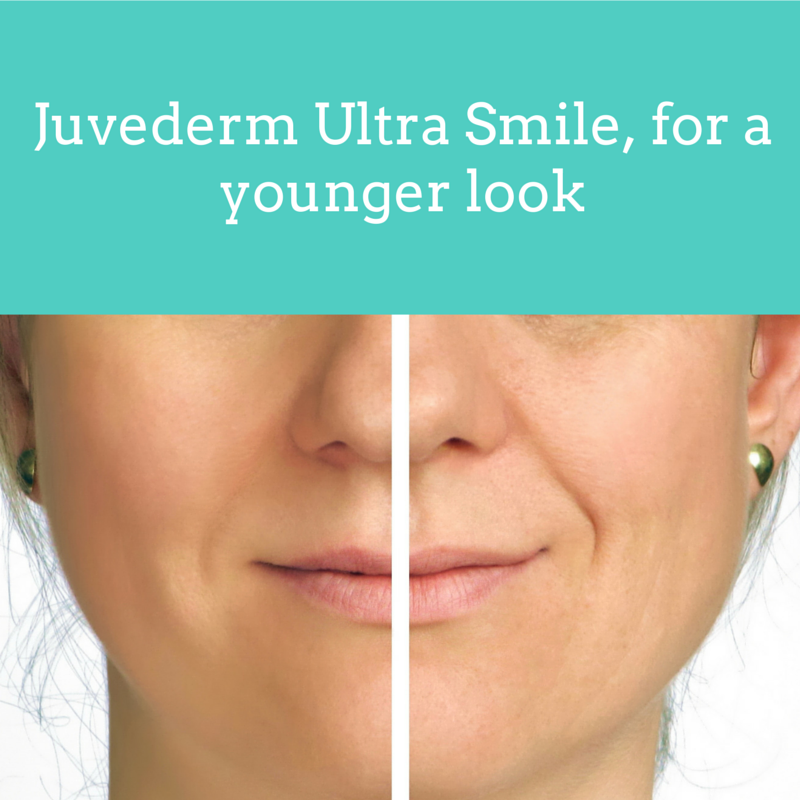 Juvederm Ultra Smile, for a younger look