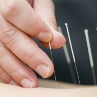 Can Acupuncture Boost Your Heart Health?