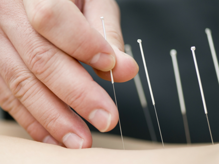 Can Acupuncture Boost Your Heart Health?