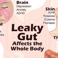 What Does a Leaky Gut Look Like?